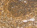 Cyclin A Antibody in Immunohistochemistry (Paraffin) (IHC (P))