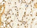 Cyclin A Antibody in Immunohistochemistry (Paraffin) (IHC (P))