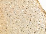 Cyclin A Antibody in Immunohistochemistry (Paraffin) (IHC (P))