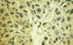 TAK1 Antibody in Immunohistochemistry (Paraffin) (IHC (P))