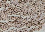 Phospho-SF1 (Ser80, Ser82) Antibody in Immunohistochemistry (Paraffin) (IHC (P))