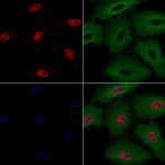 ASF1B Antibody in Immunocytochemistry (ICC/IF)