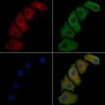 PLA1A Antibody in Immunocytochemistry (ICC/IF)