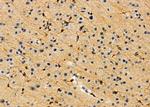 GLP2R Antibody in Immunohistochemistry (Paraffin) (IHC (P))