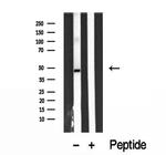 ARL13B Antibody in Western Blot (WB)