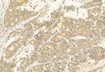 BBS5 Antibody in Immunohistochemistry (Paraffin) (IHC (P))