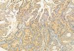 BBS5 Antibody in Immunohistochemistry (Paraffin) (IHC (P))