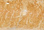 BBS5 Antibody in Immunohistochemistry (Paraffin) (IHC (P))