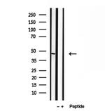 BBS5 Antibody in Western Blot (WB)