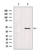 BBS5 Antibody in Western Blot (WB)