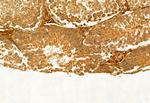 SQLE Antibody in Immunohistochemistry (Paraffin) (IHC (P))