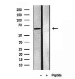 SQLE Antibody in Western Blot (WB)