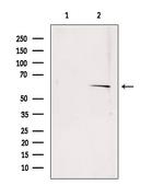 SQLE Antibody in Western Blot (WB)