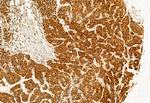 ATP Synthase beta Antibody in Immunohistochemistry (Paraffin) (IHC (P))