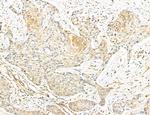 NOD2 Antibody in Immunohistochemistry (Paraffin) (IHC (P))