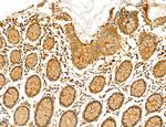 NOD2 Antibody in Immunohistochemistry (Paraffin) (IHC (P))