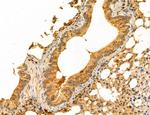 NOD2 Antibody in Immunohistochemistry (Paraffin) (IHC (P))