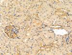 NOD2 Antibody in Immunohistochemistry (Paraffin) (IHC (P))