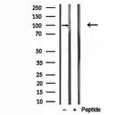 NOD2 Antibody in Western Blot (WB)