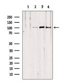 NOD2 Antibody in Western Blot (WB)