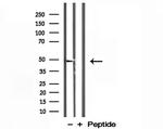 L2HGDH Antibody in Western Blot (WB)