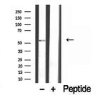 ETEA Antibody in Western Blot (WB)