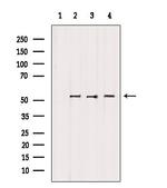 ETEA Antibody in Western Blot (WB)