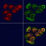 TIMM22 Antibody in Immunocytochemistry (ICC/IF)