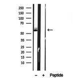 BCO2 Antibody in Western Blot (WB)