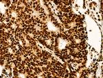 HTATSF1 Antibody in Immunohistochemistry (Paraffin) (IHC (P))