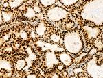 HTATSF1 Antibody in Immunohistochemistry (Paraffin) (IHC (P))