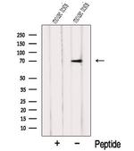 NXF2 Antibody in Western Blot (WB)