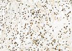 APITD1 Antibody in Immunohistochemistry (Paraffin) (IHC (P))