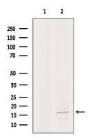 APITD1 Antibody in Western Blot (WB)