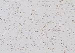 ETK Antibody in Immunohistochemistry (Paraffin) (IHC (P))