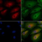 JAKMIP2 Antibody in Immunocytochemistry (ICC/IF)