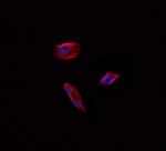 AGPAT4 Antibody in Immunocytochemistry (ICC/IF)