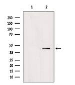 AGPAT4 Antibody in Western Blot (WB)