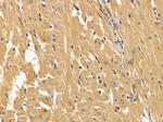 ABCD1 Antibody in Immunohistochemistry (Paraffin) (IHC (P))