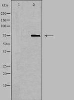 ABCD1 Antibody in Western Blot (WB)