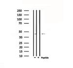 D4 Dopamine Receptor Antibody in Western Blot (WB)