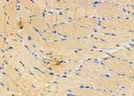 Urotensin II Receptor Antibody in Immunohistochemistry (Paraffin) (IHC (P))