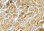 ABCA6 Antibody in Immunohistochemistry (Paraffin) (IHC (P))