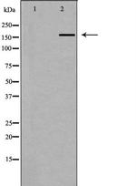 ABCA6 Antibody in Western Blot (WB)