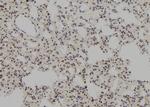 MSH3 Antibody in Immunohistochemistry (Paraffin) (IHC (P))