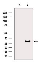 LAT Antibody in Western Blot (WB)