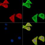 Galectin 4 Antibody in Immunocytochemistry (ICC/IF)