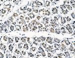 Galectin 4 Antibody in Immunohistochemistry (Paraffin) (IHC (P))