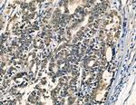 Galectin 4 Antibody in Immunohistochemistry (Paraffin) (IHC (P))