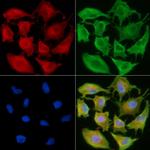 AATK Antibody in Immunocytochemistry (ICC/IF)